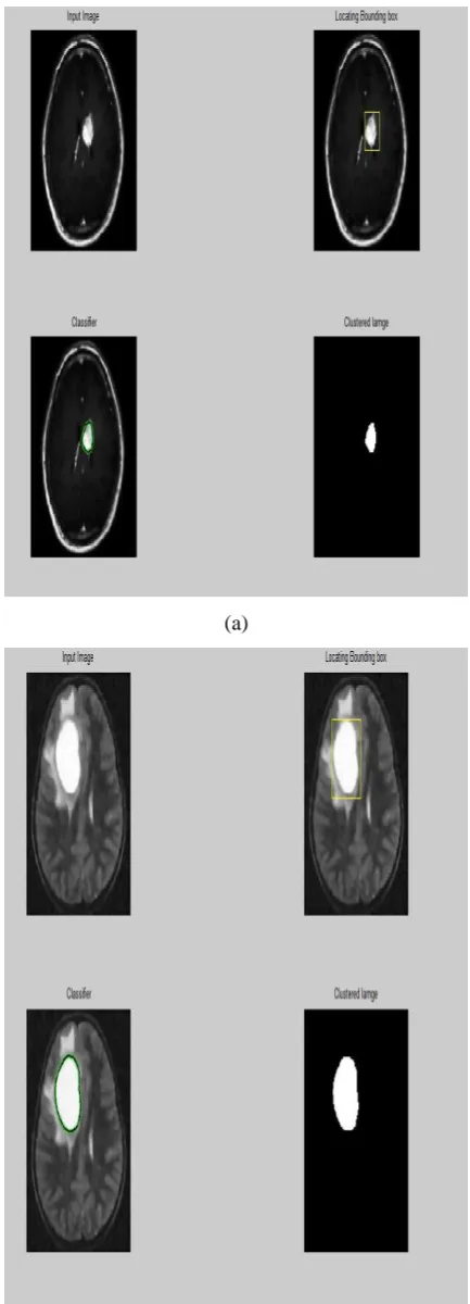 Fig. 1. Comparison results. (a)(a1), (b)(b1), (c)(c1) are three different positions of Brain cerebral 