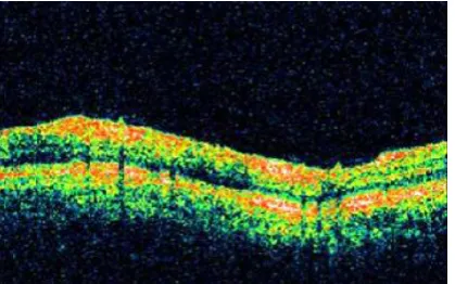 Fig 2.1 Enhanced Image 