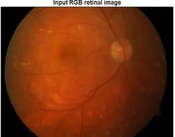 Fig 2: Input retinal RGB image 