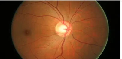 Fig 1: Human Retina 