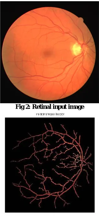 Fig 2: Retinal input image 