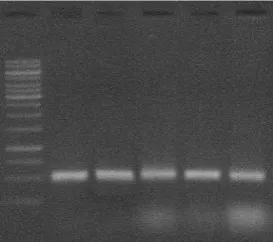 Figure 9: cDNA Synthesis: Agarose Gel Electrophoresis: Lane 1: Marker : Lane 2,3,4,5,6 -   MRC-5 fibroblast cells
