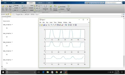 Fig .3 Display of heart rate module  