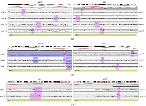 Figure 1. Balanced translocations detected by tCGH in B-cell ALL cases. The probes (pink dots) form a peak, indicating the am-in cases 7, 8, and 12