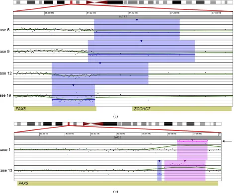 Figure 2. Copy number gains and losses of the gene PAX5 at 9p13.2 detected by microarray analysis