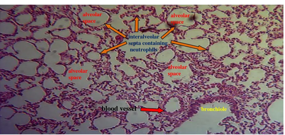 Figure 4.4 – Lung histochemical study of Saline (Control) and LPS treated rats (magnification x40)