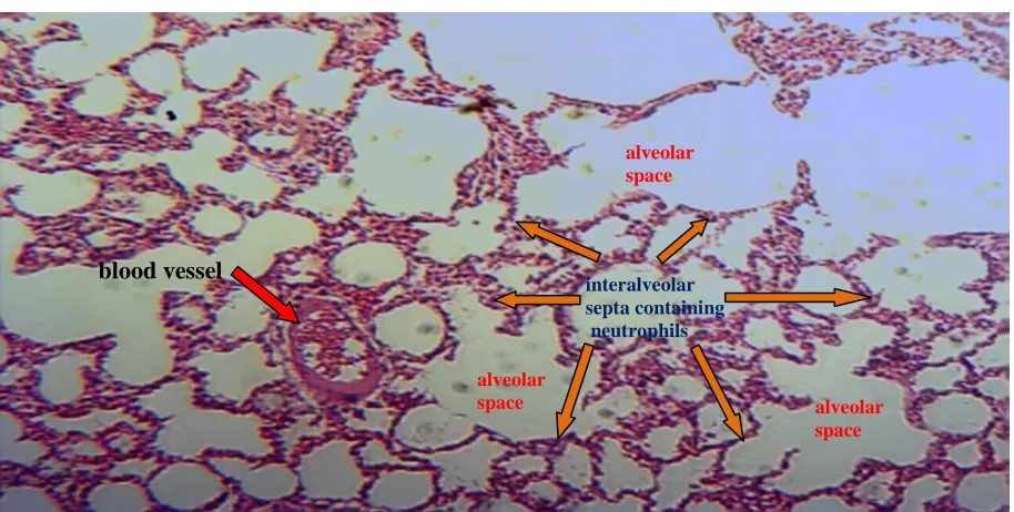 Figure 4.5 - Lung histochemical study of AGRPS and AQ extract treated rats after LPS Challenge 