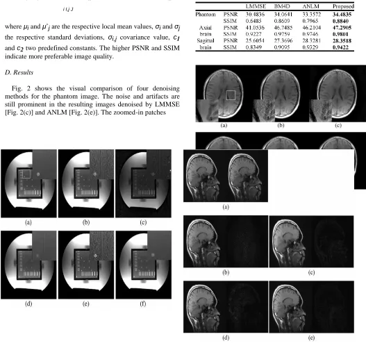 Fig. 2 shows the visual comparison of four denoising methods for the phantom image. The noise and artifacts are 