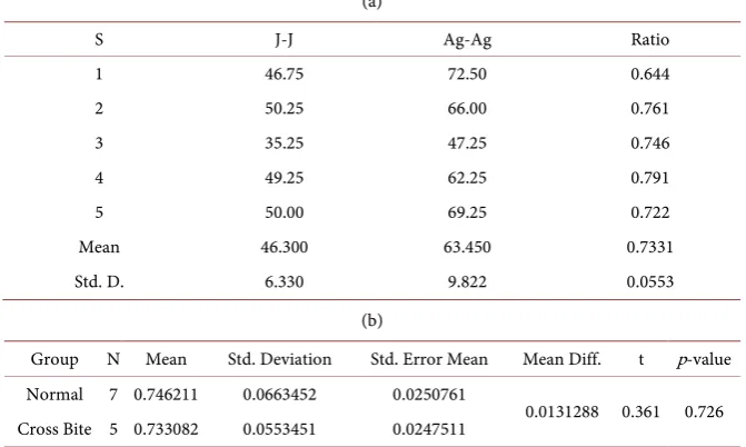 Table 2. Descriptive statistics for the 2D PA measurements of J-J, Ag-Ag, and their ratios (J-J/Ag-Ag) in the non crossbite subjects (S)
