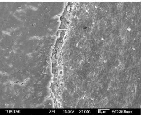 Figure 2. The sealer at the D/S and D/GP intefaces is visually compact with no voids. 