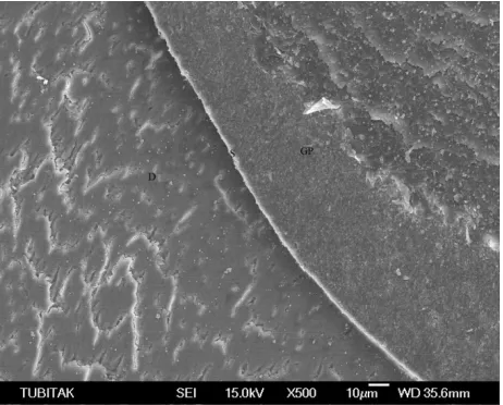 Figure 3. The appearance of the S/D interface is linear with absence of smear layer that was efficiently removed with ir- rigation protocol