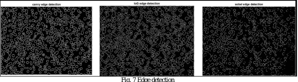 Fig. 6 Histogram stretching and stretched image  
