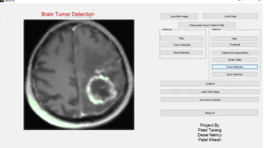 Figure 11 Final Tumor Detection  