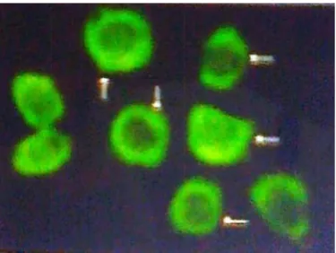 Figure 1. Cell Adhesion Assay: Cell adhesion assay of B16F10 cells treated with black tea 48 hrs; ((b) Control and 20/40/80 μg/ml) was performed following the method described extract for 24 hrs & 48 hrs ((a) Control and 20/40/80 μl/ml) and with theaflavin