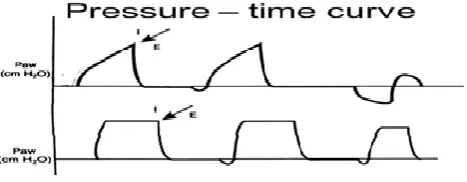 Figure 3: Pressure-Time Curve 