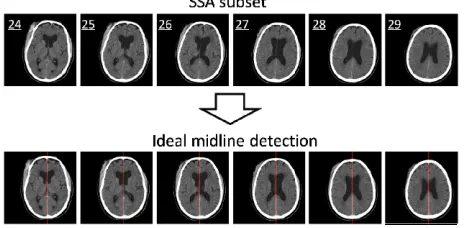 Figure 9. The results of the SSA algorithm (the upper fig-ures) and the ideal midline detection (the lower figures)