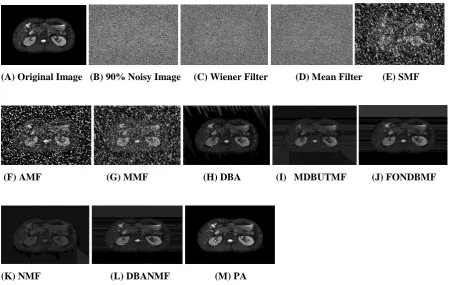 Fig.8(A).The comparative analysisof different de-noising algorithms of MR images corrupted by salt-and-