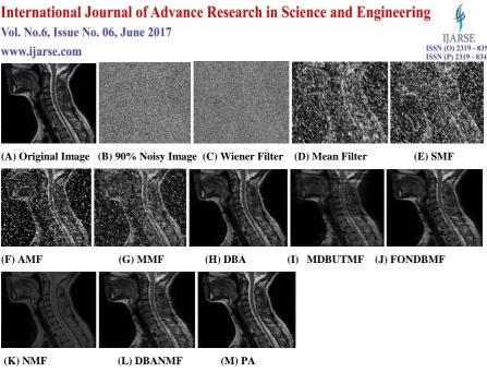 Fig. 8. Comparative analyses of Noise removal techniques for Spine MRI in 90% Salt and pepper Noise density