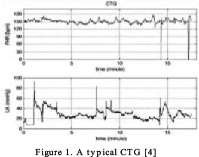 Figure 1. A ty p ical CTG [4] 