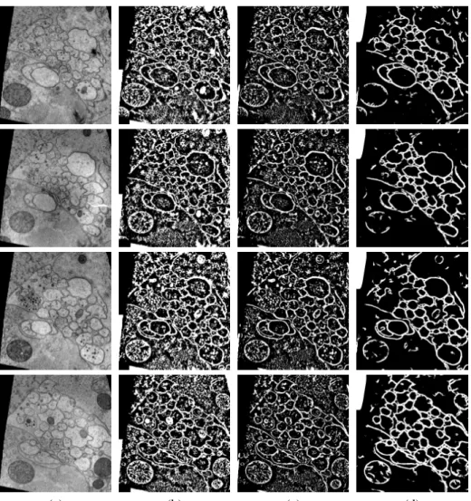 Figure 4: Different membrane segmentations for four test images, each trained using one fold from the five fold cross-validation strategy