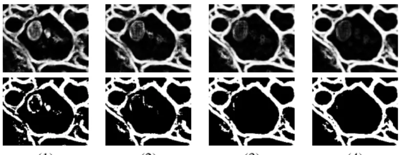 Figure 5: An example of an image in each stage (1-4) of the network series. At each stage, the network learns more about pixels that do and do not belong to the  mem-brane