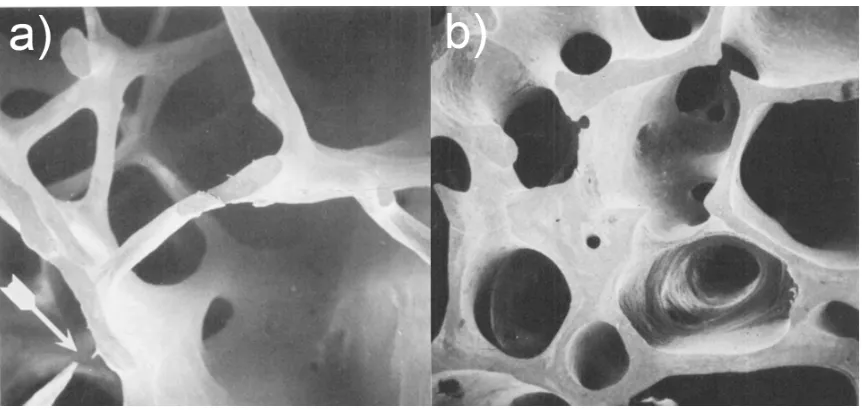 Figure 1-2 (a) An osteoporotic bone has degenerated trabecular network due to excess bone resorption, resulting in a decrease of bone structural integrity