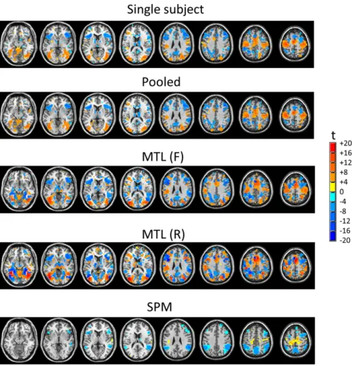 Fig. 7. One sample t-test measuring the contribution of each brain region to the classiﬁer prediction for the VAL v INVAL contrast