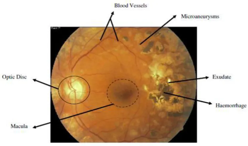 Figure 1: Fundus Image 