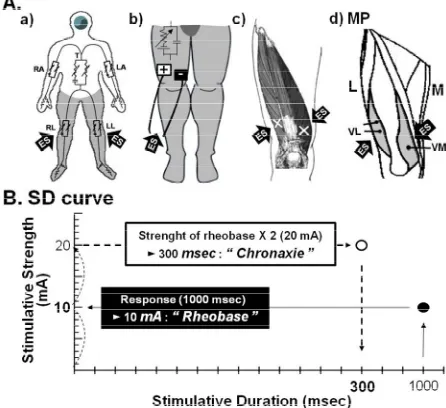 Figure 1. Schematic representation of the measurements of LA, left arm; RL, right leg; LL, left leg; +, anode; →lateralis; VM, vastus medialis; ES, electrical stimulation; MP, motor point; M, medial side; L, lateral side; SD curve, strength- rheobase and c