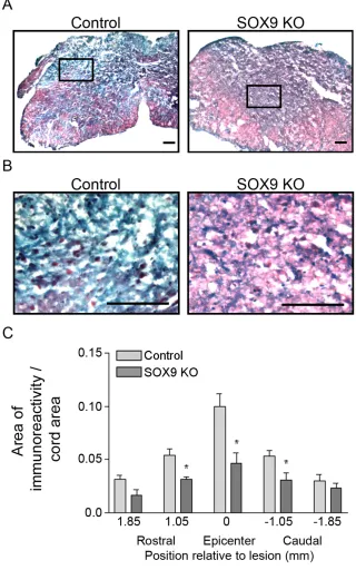 Figure 6. Sox9 conditional knockdown mice demonstrate reduced collagen at the 