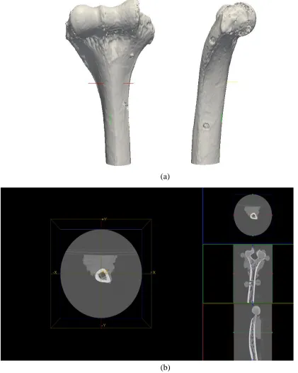Figure 1.5: (a) 3D representation of distal humerus acquired by CT scanner, and (b) ‎