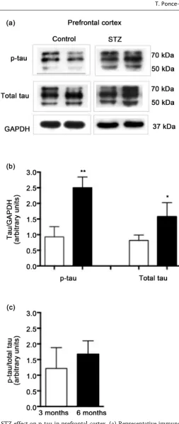 Figure 4. STZ effect on p-tau in prefrontal cortex. (a) Representative immunoblots from Significant differences (*p < 0.05, **p < 0.01) in STZ vs