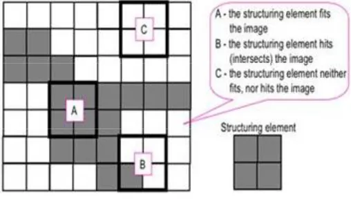 Fig  (3): Enhanced image using Median Filter.