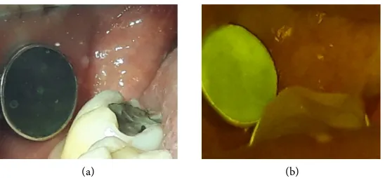 Figure 3. W.E. female, age 32—control group—retromolar mucosa: (a) Optical photo— healthy mucosa, pink, shining and smooth surface