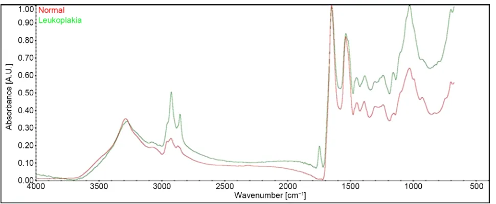 Figure 4. The FTIR-ATR spectrum of leukoplakia (green line) and normal (red line) tissue