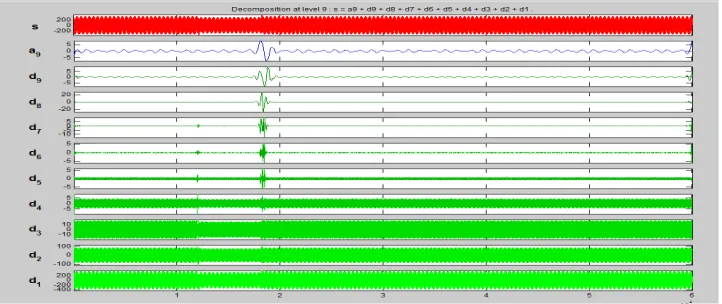 Fig 15: Decomposition of Sag with Transient waveform at level 9 
