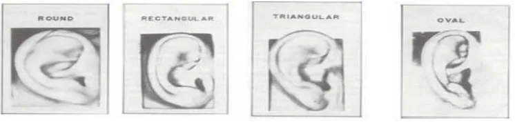 Fig. 2: Iannarellis classiﬁcation based on the shape of ear helix. 