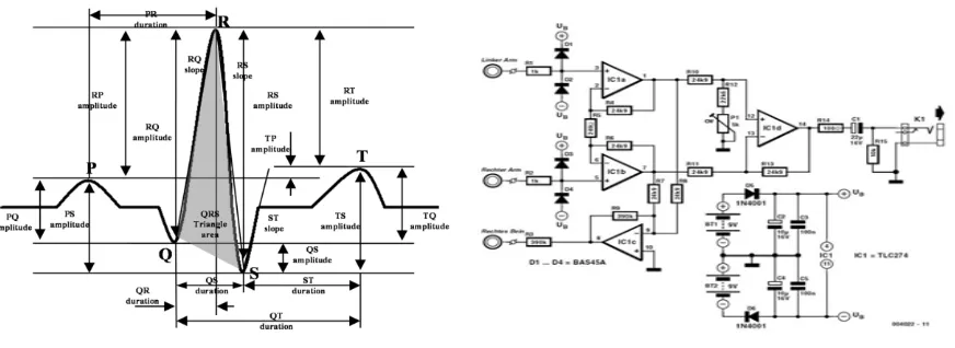 Fig. 1: The Electrocardiogram (ECG) plot                              Fig 2 Circuit Diagram for ECG Amplifier 