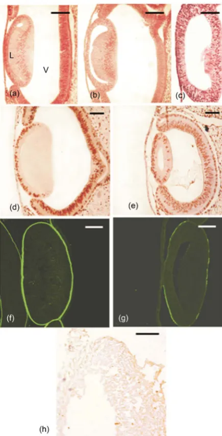 Figure 3. Heparinase II-treated lens anlagen: Micrographs of middle sections of chick lens anlagen of E23H.H
