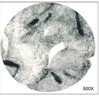 Figure 2. Subzero chilled cast iron (etched) showing matrix structure (ledeburite matrix structure)