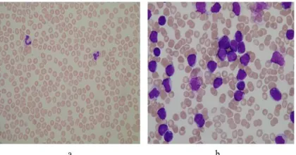 Fig. 1 Image from Database. (a) Healthy Cells, (b)Cancerous Cells.  
