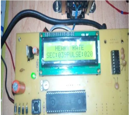 Fig .4. Heartbeat display  