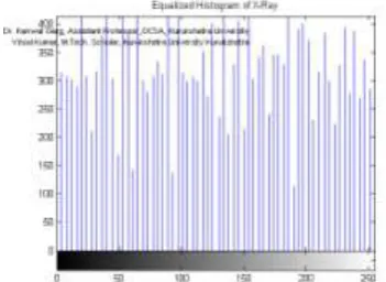 Fig. 2(e): Equalized Histogram of X-ray 