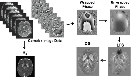 Figure 3.5: Full processing pipeline utilized in this thesis for channel combination, R2*, 