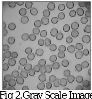 Fig 4 Canny Edge Detection Image   