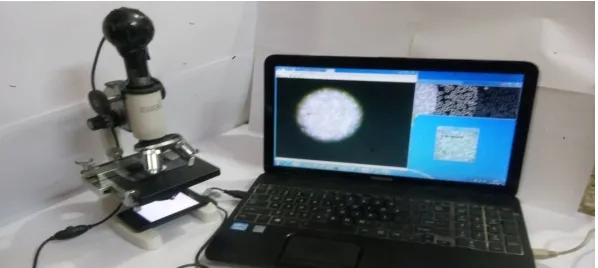 Fig 8Microscope Mounted With Web Camera Interfaced With Computer Showing Live Image Of RBCs   Actual rbc count per cm3= (RBCs counted by image processing / ((input image area/(magnification *magnification)*film thickness))*dilution factor 