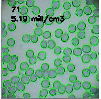 Fig 9.Original Image of the cells  