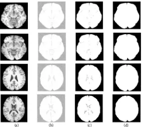 Figure 3. Low contrasts MRI image segmentation based on improved dictionary learning genetic algorithm