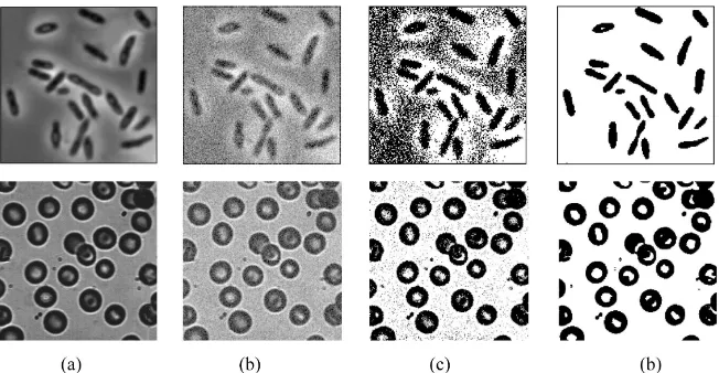 Figure 5. Bacterial image segmentation based on improved genetic algorithm based on dictionary learning