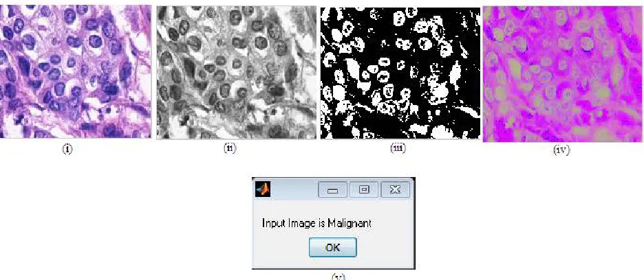 Figure 5(b) Experimental Result for an input image after applying CNN classification (i) Query image (ii) Gray scale image (iii) Binary image (iv) HSV image and (v) Result